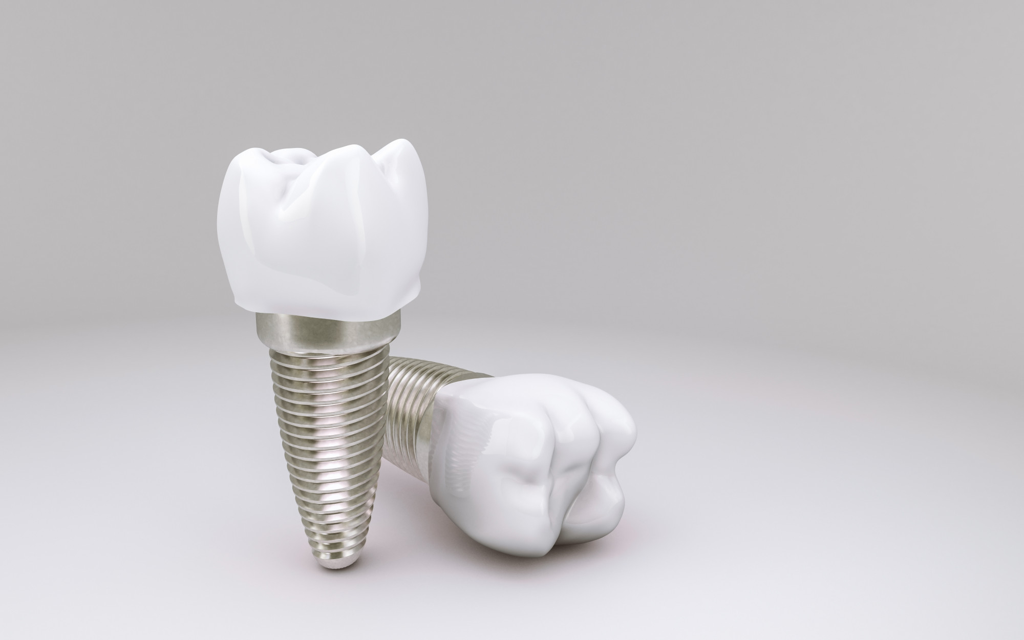 Dental Implant